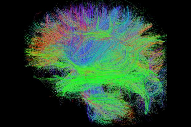 Brain white matter tracts on black background