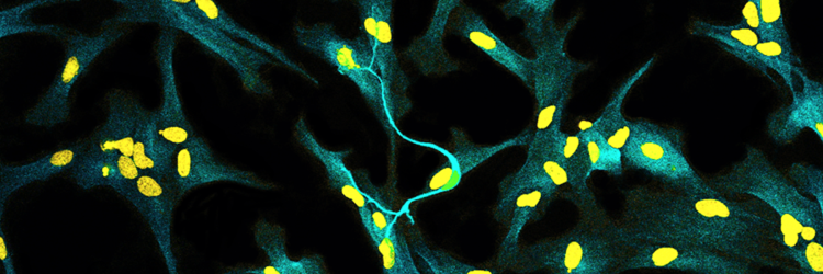 microscopic image of human neuron with astrocytes.Yellow and green pattern